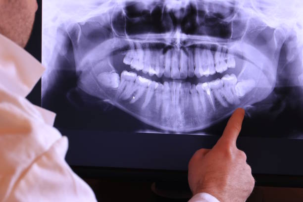 Best Emergency Treatment for Oral Infections in Mount Pleasant, SC