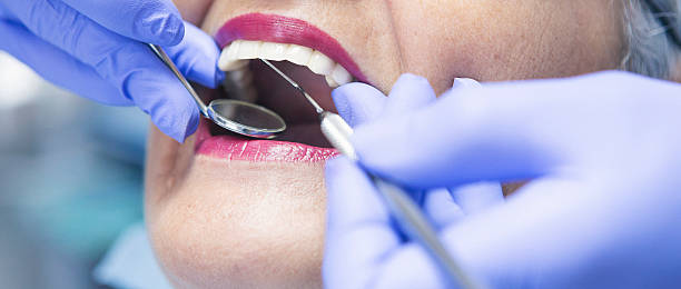  Mount Pleasant, SC Emergency Dentist Pros